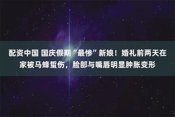 配资中国 国庆假期“最惨”新娘！婚礼前两天在家被马蜂蜇伤，脸部与嘴唇明显肿胀变形